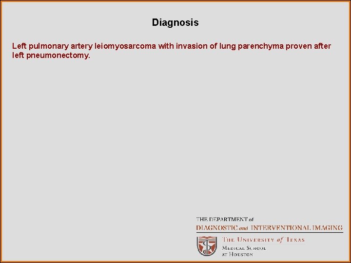 Diagnosis Left pulmonary artery leiomyosarcoma with invasion of lung parenchyma proven after left pneumonectomy.