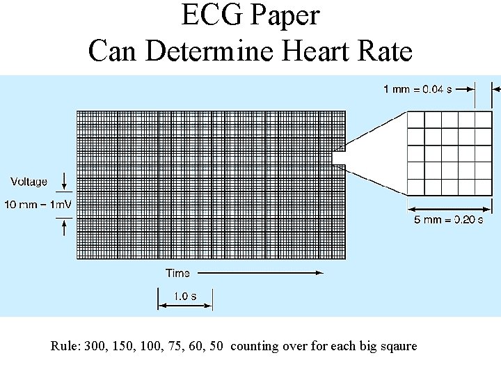 ECG Paper Can Determine Heart Rate Rule: 300, 150, 100, 75, 60, 50 counting