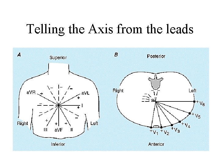 Telling the Axis from the leads 