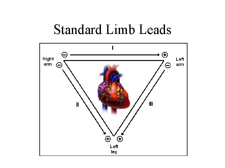 Standard Limb Leads 