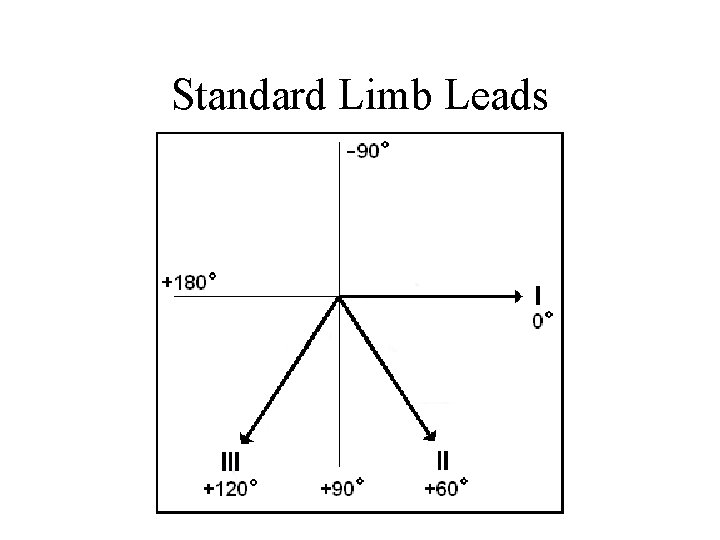 Standard Limb Leads 