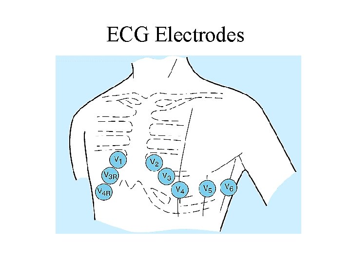 ECG Electrodes 