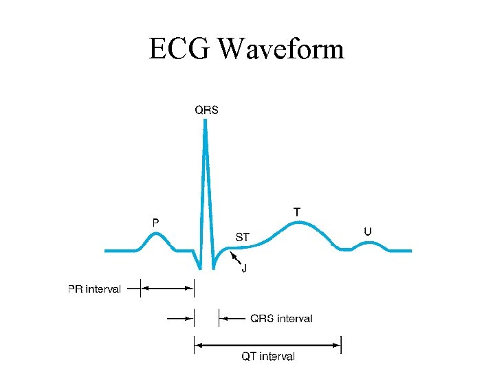 ECG Waveform 