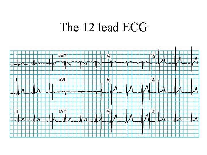 The 12 lead ECG 