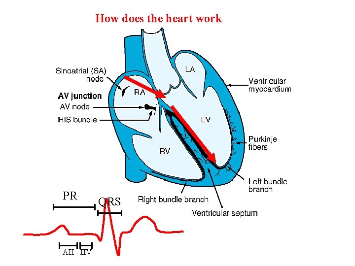 How does the heart work PR AH HV QRS 