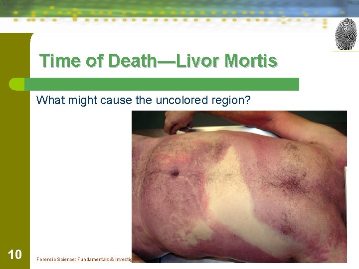 Time of Death—Livor Mortis What might cause the uncolored region? 10 Forensic Science: Fundamentals