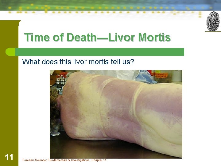 Time of Death—Livor Mortis What does this livor mortis tell us? 11 Forensic Science: