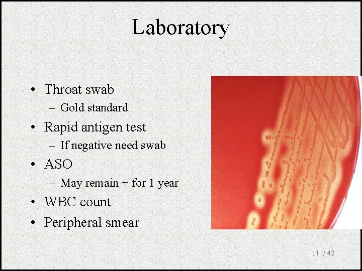 Laboratory • Throat swab – Gold standard • Rapid antigen test – If negative