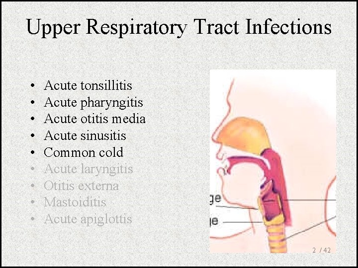 Upper Respiratory Tract Infections • • • Acute tonsillitis Acute pharyngitis Acute otitis media