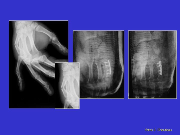 fotos J. Chouteau fotos J. Chouteau