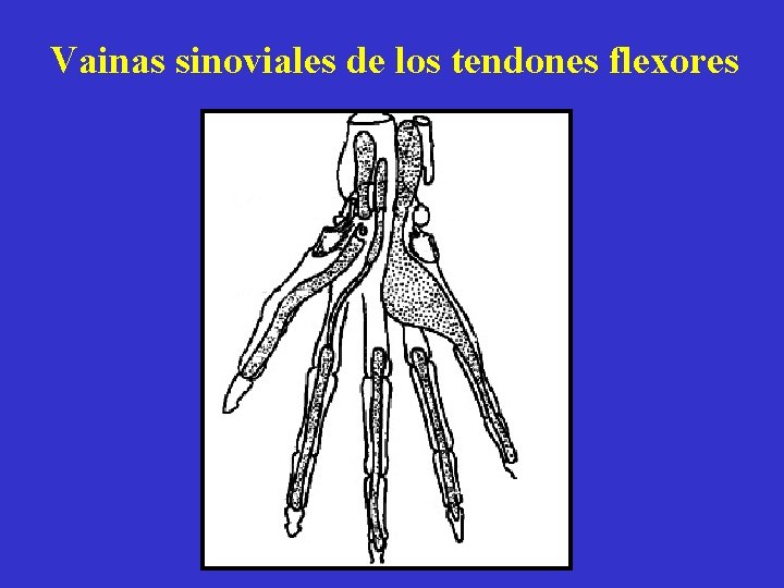 Vainas sinoviales de los tendones flexores Vainas sinoviales de los tendones flexores
