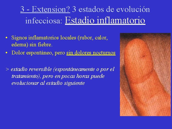 3 - Extension? 3 estados de evolución infecciosa: Estadio inflamatorio • Signos inflamatorios locales