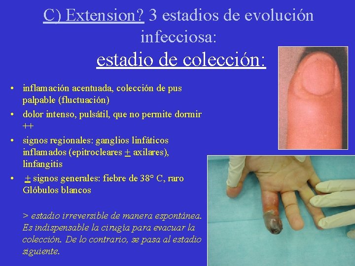 C) Extension? 3 estadios de evolución infecciosa: estadio de colección: • inflamación acentuada, colección C) Extension? 3 estadios de evolución infecciosa: estadio de colección: • inflamación acentuada, colección