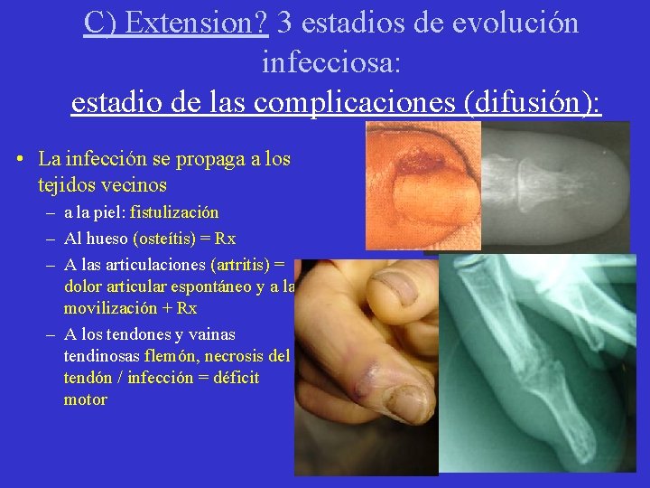 C) Extension? 3 estadios de evolución infecciosa: estadio de las complicaciones (difusión): • La