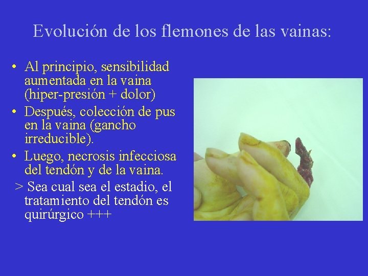 Evolución de los flemones de las vainas: • Al principio, sensibilidad aumentada en la