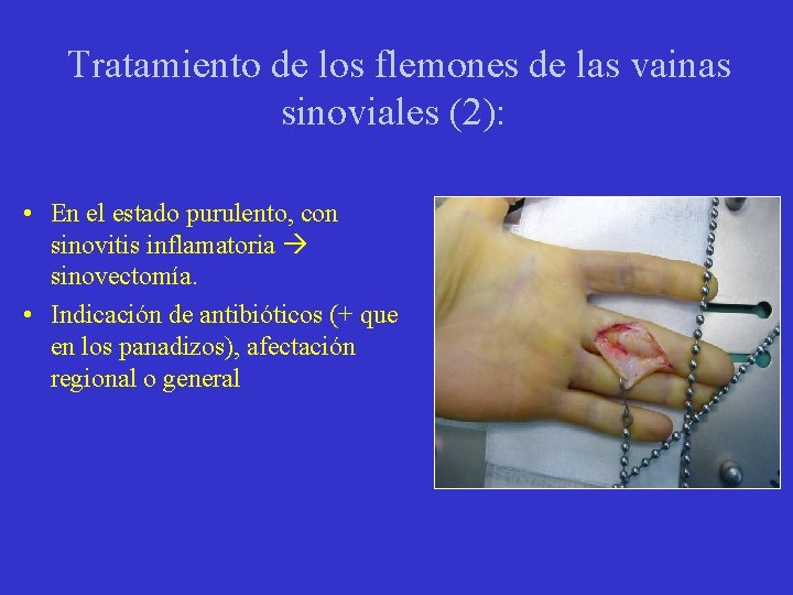 Tratamiento de los flemones de las vainas sinoviales (2): • En el estado purulento,