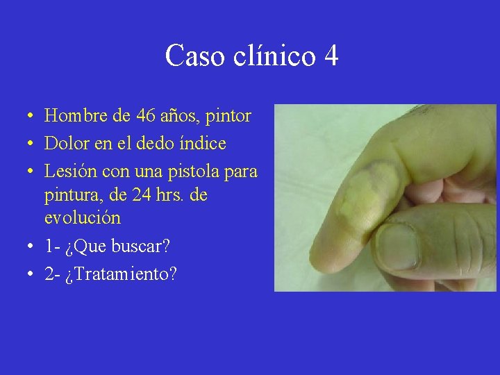 Caso clínico 4 • Hombre de 46 años, pintor • Dolor en el dedo Caso clínico 4 • Hombre de 46 años, pintor • Dolor en el dedo