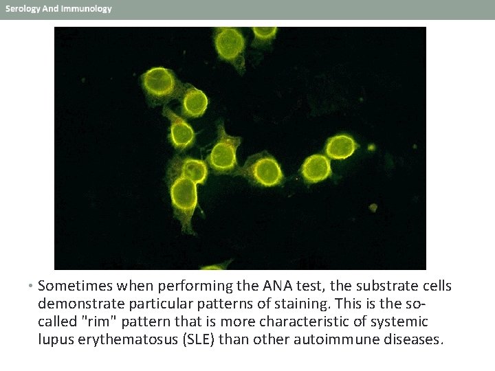  • Sometimes when performing the ANA test, the substrate cells demonstrate particular patterns