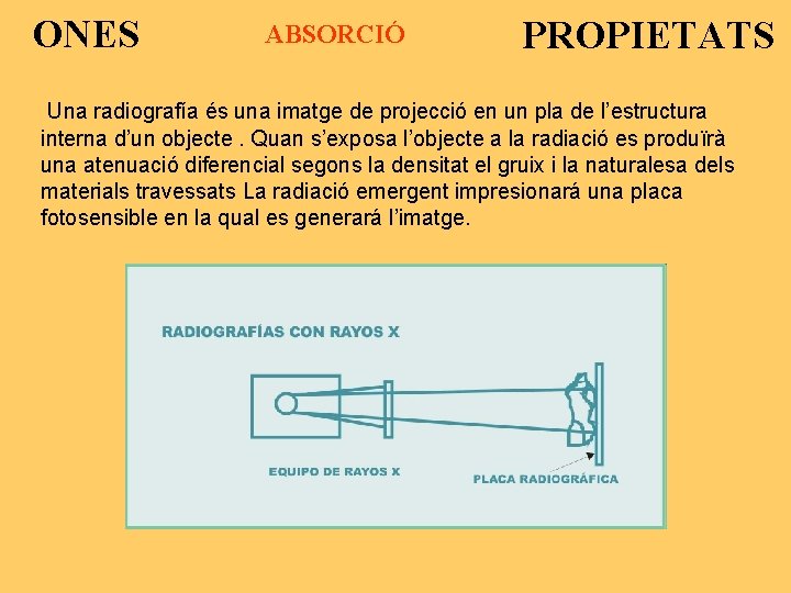 ONES ABSORCIÓ PROPIETATS Una radiografía és una imatge de projecció en un pla de