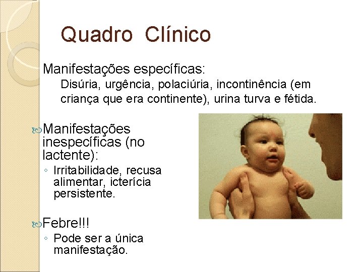 Quadro Clínico Manifestações específicas: Disúria, urgência, polaciúria, incontinência (em criança que era continente), urina