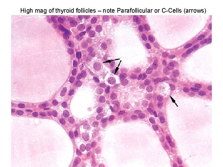 High mag of thyroid follicles – note Parafollicular or C-Cells (arrows) 
