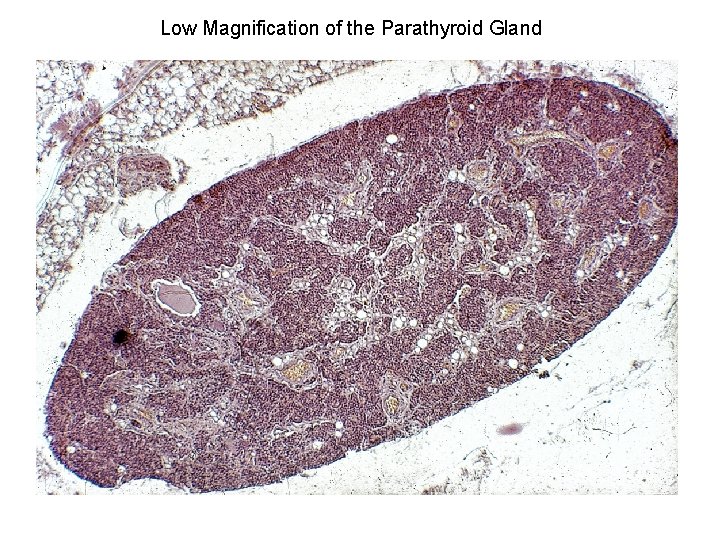 Low Magnification of the Parathyroid Gland 