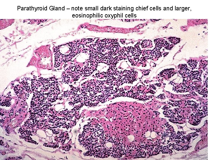 Parathyroid Gland – note small dark staining chief cells and larger, eosinophilic oxyphil cells