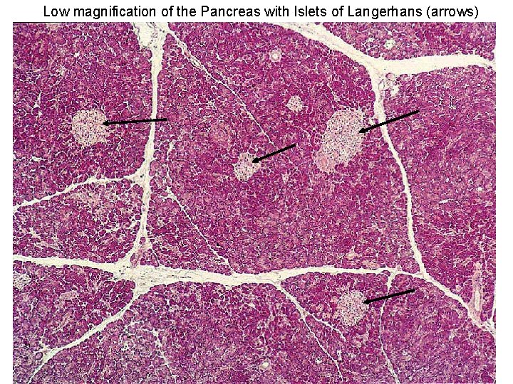 Low magnification of the Pancreas with Islets of Langerhans (arrows) 