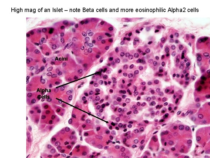 High mag of an Islet – note Beta cells and more eosinophilic Alpha 2