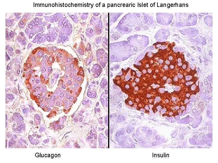 Immunohistochemistry of a pancrearic Islet of Langerhans Glucagon Insulin 