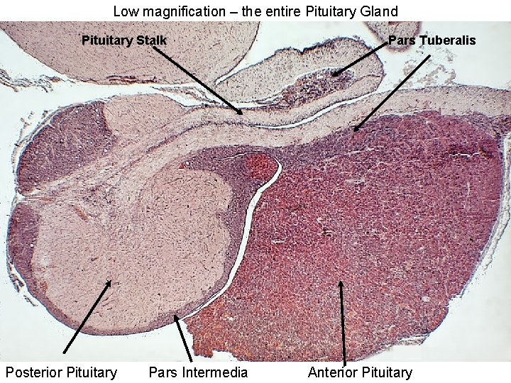 Low magnification – the entire Pituitary Gland Pituitary Stalk Posterior Pituitary Pars Intermedia Pars