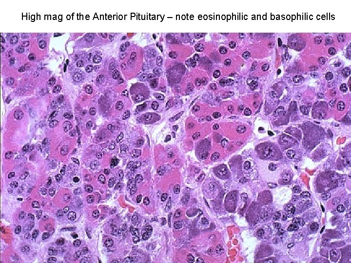High mag of the Anterior Pituitary – note eosinophilic and basophilic cells 