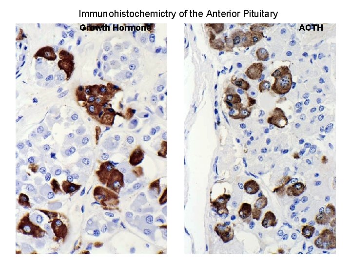 Immunohistochemictry of the Anterior Pituitary Growth Hormone ACTH 