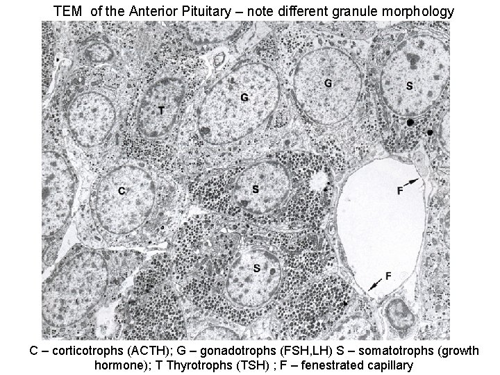 TEM of the Anterior Pituitary – note different granule morphology C – corticotrophs (ACTH);