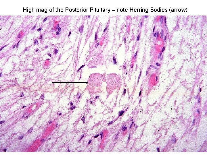 High mag of the Posterior Pituitary – note Herring Bodies (arrow) 
