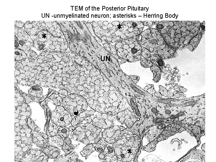 TEM of the Posterior Pituitary UN -unmyelinated neuron; asterisks – Herring Body 