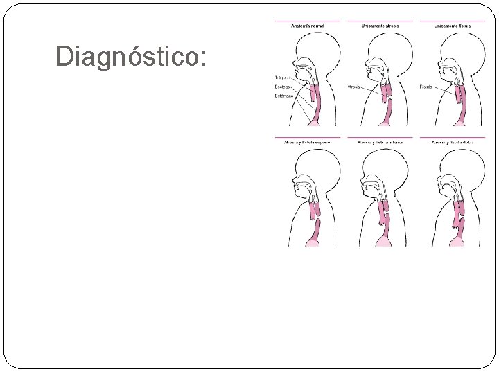 Diagnóstico: 