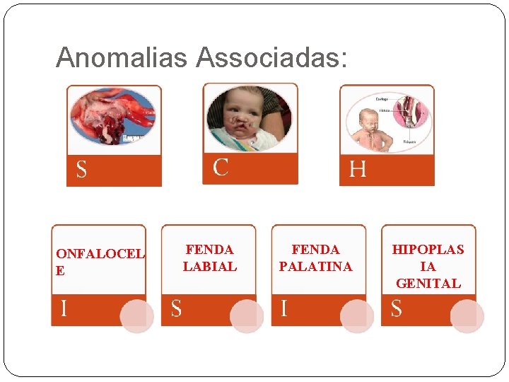 Anomalias Associadas: ONFALOCEL E FENDA LABIAL FENDA PALATINA HIPOPLAS IA GENITAL 