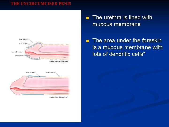 THE UNCIRCUMCISED PENIS n The urethra is lined with mucous membrane n The area