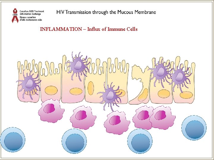 INFLAMMATION – Influx of Immune Cells 