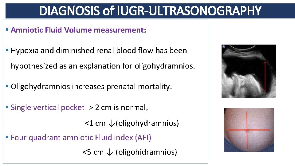 DIAGNOSIS of IUGR-ULTRASONOGRAPHY § Amniotic Fluid Volume measurement: § Hypoxia and diminished renal blood