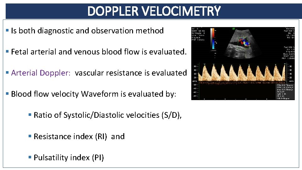 DOPPLER VELOCIMETRY § Is both diagnostic and observation method § Fetal arterial and venous