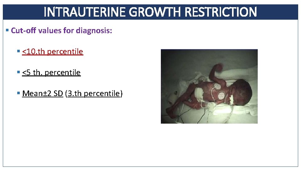 INTRAUTERINE GROWTH RESTRICTION § Cut-off values for diagnosis: § <10. th percentile § <5 INTRAUTERINE GROWTH RESTRICTION § Cut-off values for diagnosis: § <10. th percentile § <5