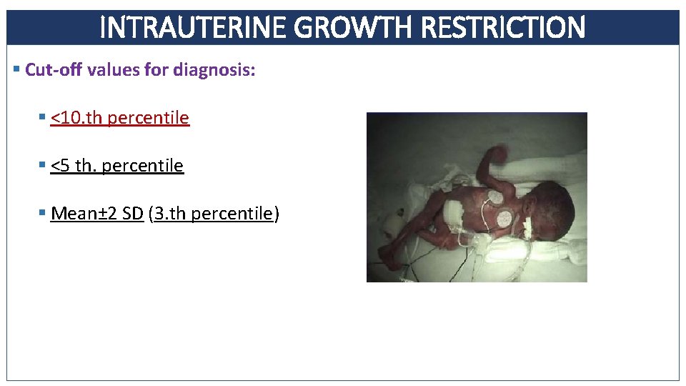 INTRAUTERINE GROWTH RESTRICTION § Cut-off values for diagnosis: § <10. th percentile § <5