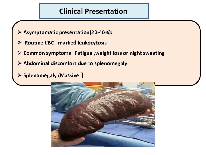 Clinical Presentation Ø Asymptomatic presentation(20 -40%): Ø Routine CBC : marked leukocytosis Ø Common