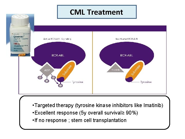 CML Treatment • Targeted therapy (tyrosine kinase inhibitors like Imatinib) • Excellent response (5