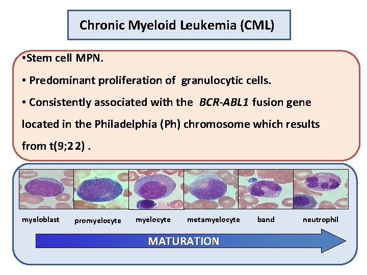 Chronic Myeloid Leukemia (CML) • Stem cell MPN. • Predominant proliferation of granulocytic cells.