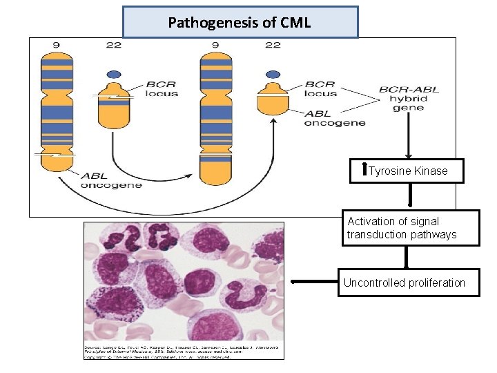 Pathogenesis of CML Tyrosine Kinase Activation of signal transduction pathways Uncontrolled proliferation 