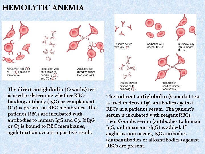 HEMOLYTIC ANEMIA The direct antiglobulin (Coombs) test is used to determine whether RBCbinding antibody