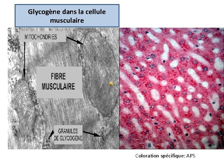 Glycogène dans la cellule musculaire Coloration spécifique: APS 